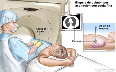 Tuxpan, sede de curso sobre diagnóstico y tratamiento de tumores músculo-esqueléticos
