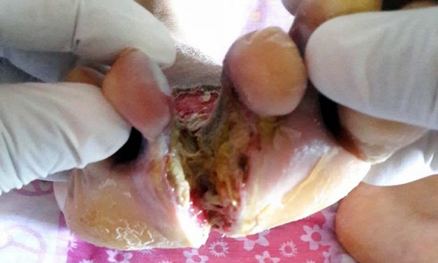 Negligencia Médica en el Hospital Civíl