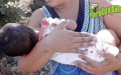 Bebé herido en accidente motociclístico