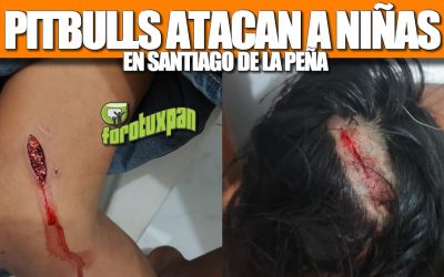 PITBULLS ATACAN A NIÑAS EN SANTIAGO DE LA PEÑA