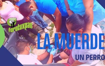 La muerde un Perro en la México Lindo
