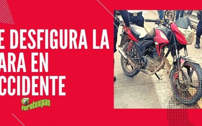 SE DESFIGURA LA CARA EN DERRAPE