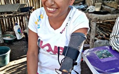 Tamiahua: Entrega de prótesis de mano en Papatlar