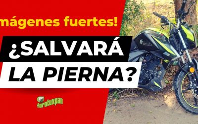 ¡Podría perder la pierna!