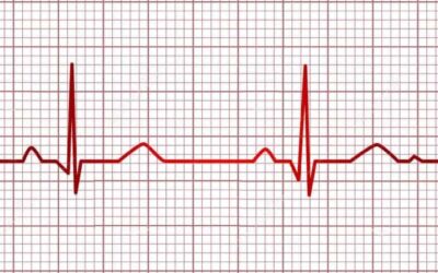 DIF Tuxpan realizará Jornada de Electrocardiogramas gratuitos