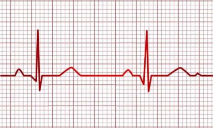 DIF Tuxpan realizará Jornada de Electrocardiogramas gratuitos