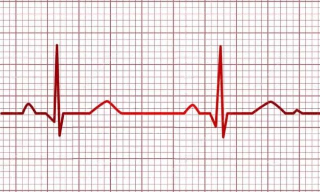 DIF Tuxpan realizará Jornada de Electrocardiogramas gratuitos